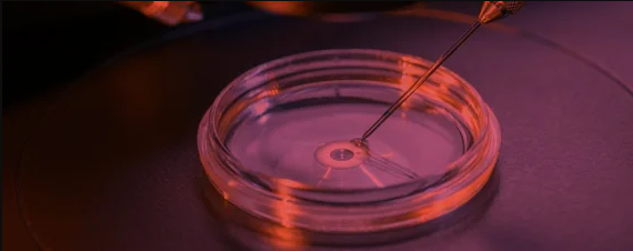 IN VITRO FERTILISATION (IVF)