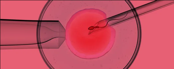 INTRACYTOPLASMIC SPERM INJECTION (ICSI)