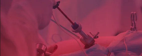 LAPAROSCOPY &amp; HYSTEROSCOPY